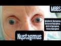 Nystagmus- Optokinetic, Horizontal, Vertical, Rotary #mbbs #medicine #neetpg #usmle