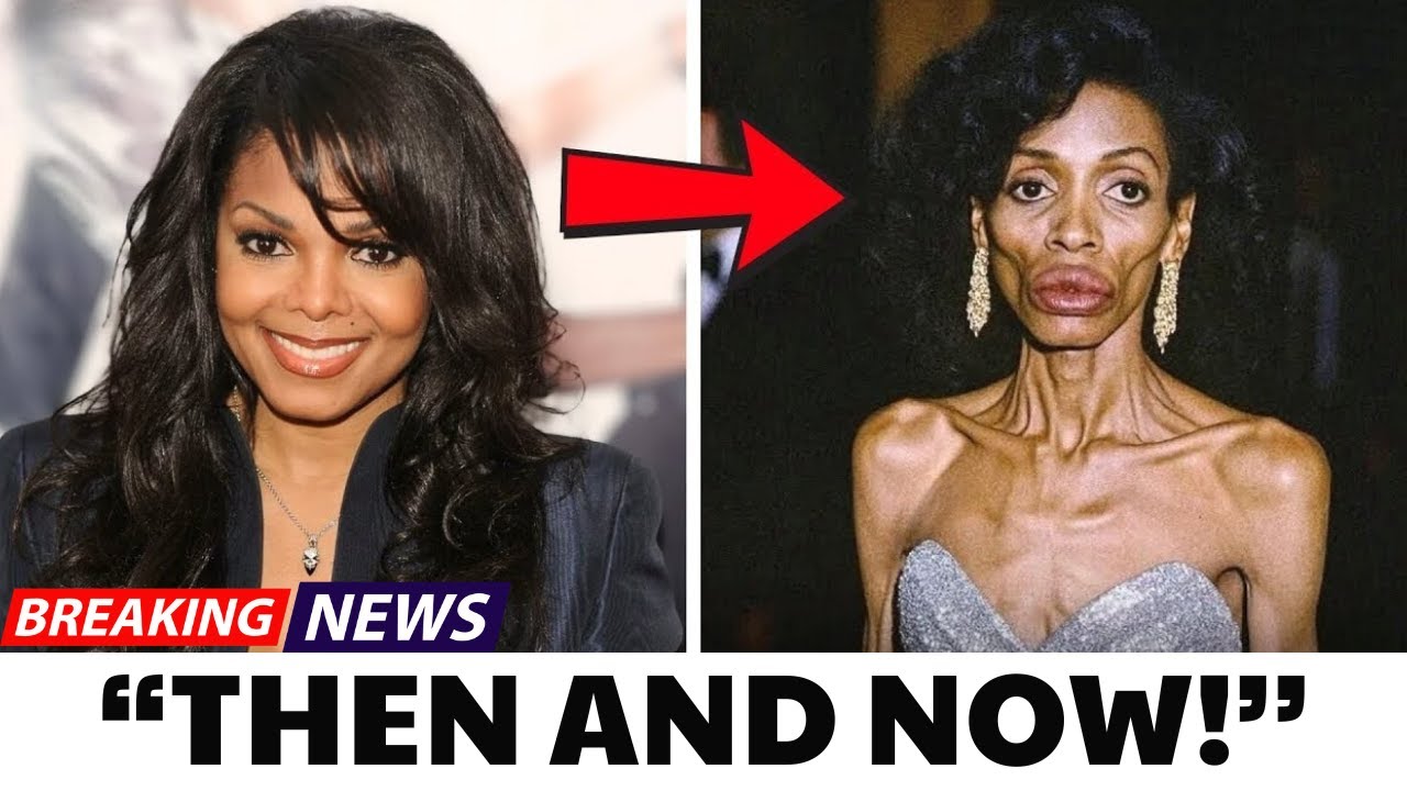 23 Black Celebrities Who Secretly Had Plastic Surgery You Didn’t Know About P2  Then and now 2026