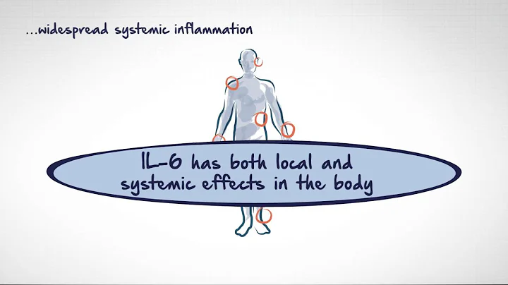 The role of interleukin-6 in autoimmune diseases