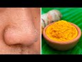 How to Get Rid of Blackheads on Your Nose