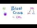 Blast Crisis in CML | When Chronic Myeloid Leukemia Goes Mad!