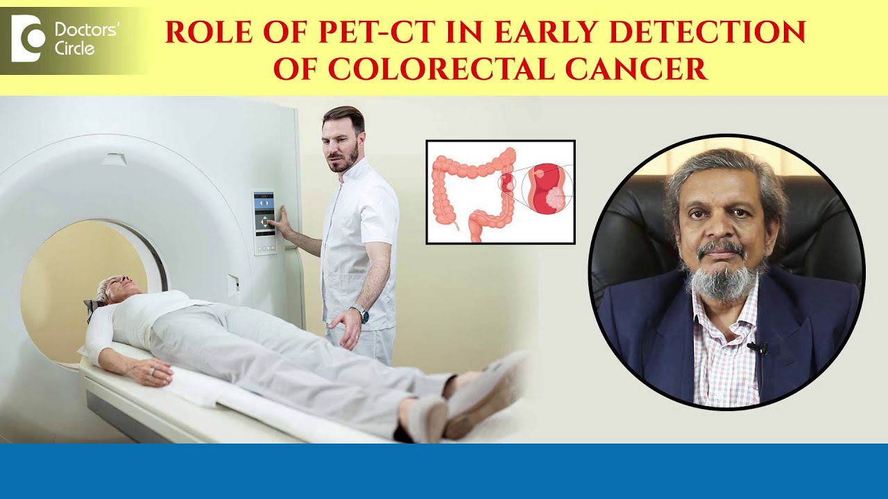 How accurate is PET-CT Scan for Early detection of Colon Cancer?-Dr ...