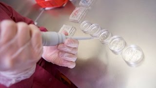 Fertility Treatments Raise Mothers’ Risks of Health Problems in Delivery