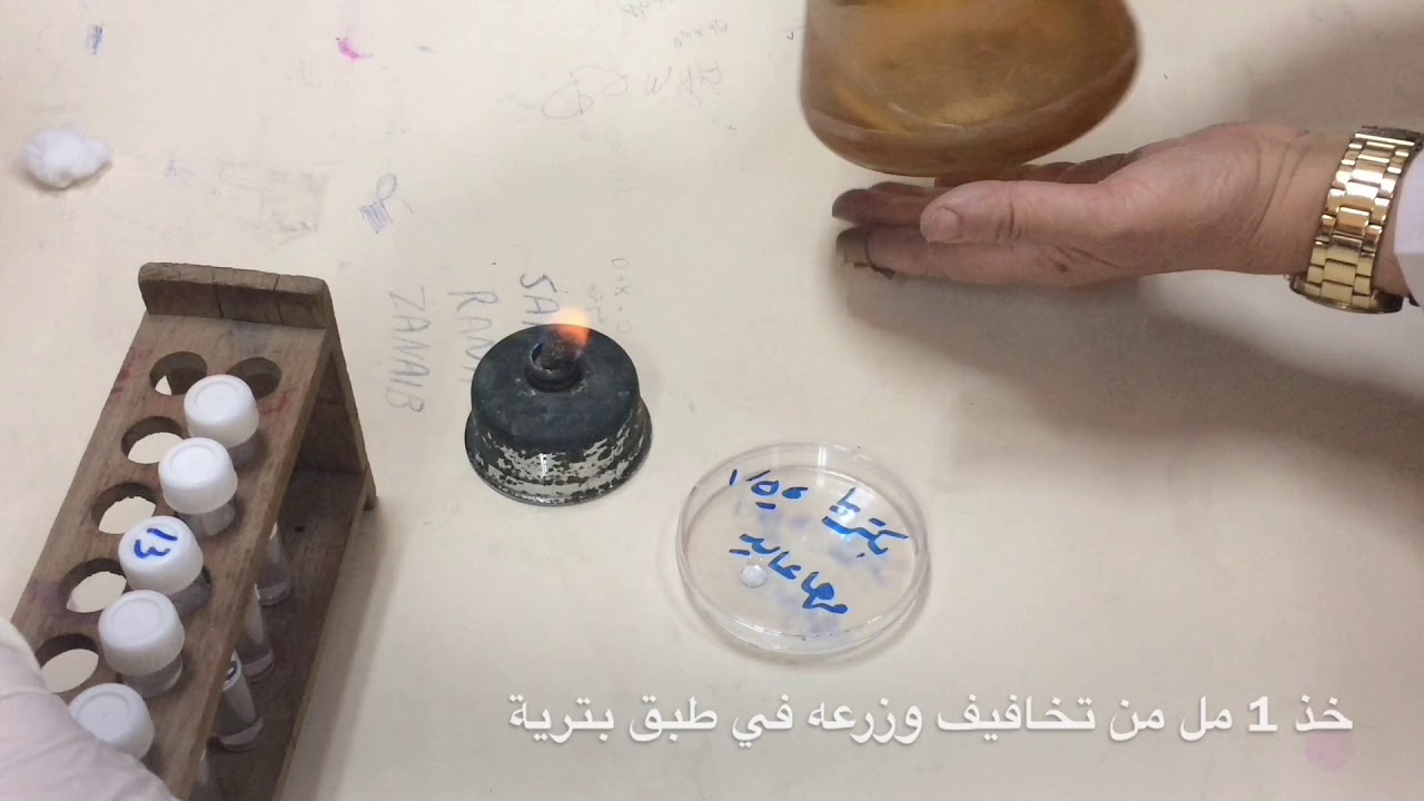 تقدير الاحياء بطريقة التخفيف والعد بالاطباق