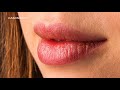 Искусcтво увеличения губ. Art of lip injection / KAMINSKYI