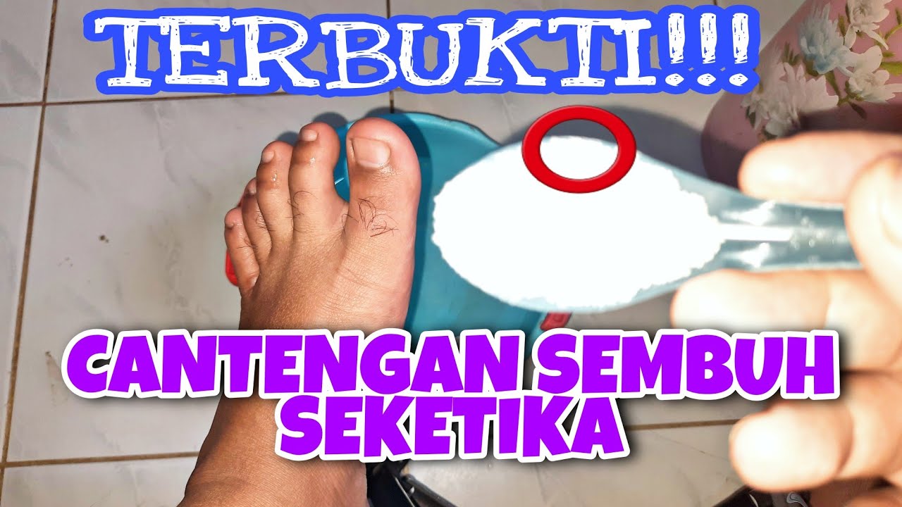 🔥Cara Ampuh Mengobati Cantengan Jempol Jari Kaki Dengan Di Rendam Air