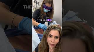 Sun Damage In Your 50S Can It Be Reversed?