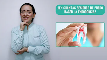 ¿Cuántas citas debe tener una endodoncia?