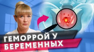 Геморрой при беременности - что делать? #геморрой #беременность #проктолог