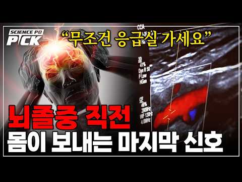 If you experience 'this symptom', has a stroke already begun? The 'danger signals' sent by our ce...