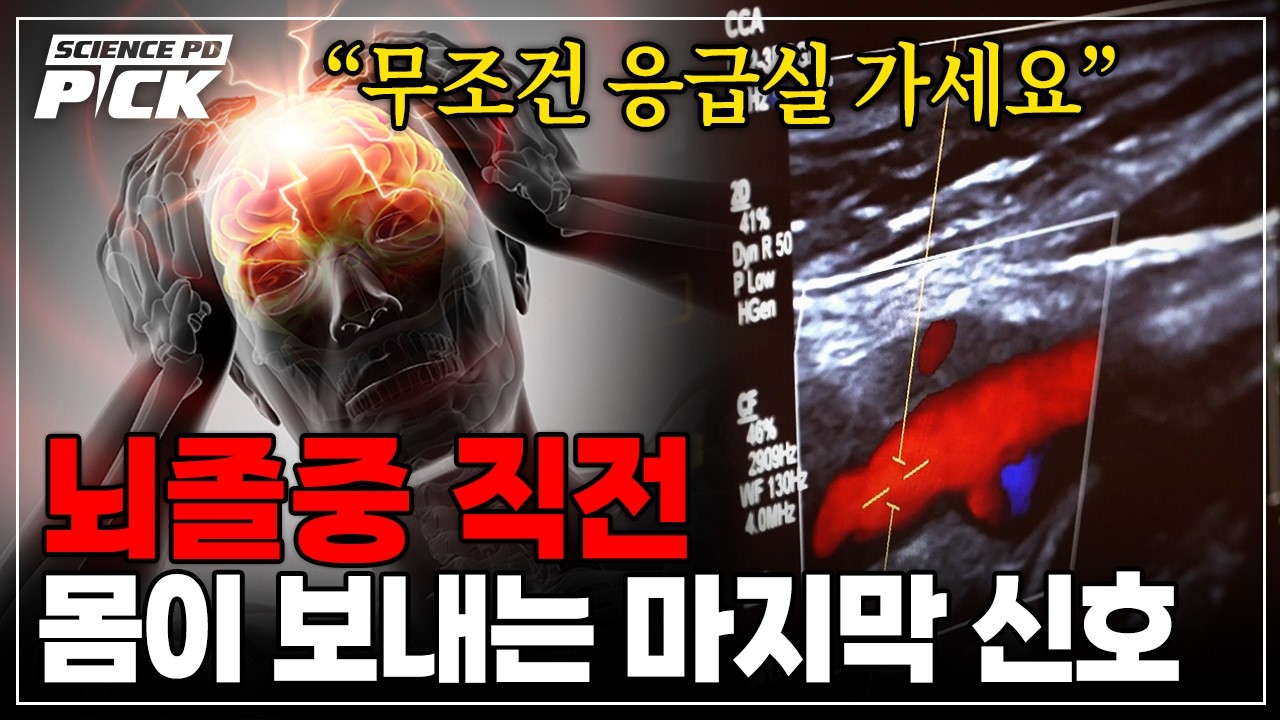 '이 증상' 나타나면 이미 뇌졸중 시작됐다? 우리 뇌혈관이 보내는 '위험 신호' [Science PD Pick] / YTN 사이언스