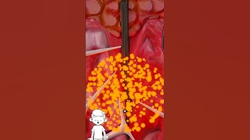 How Splinters Get Stuck and Removed Explained In 3d Animation #shorts