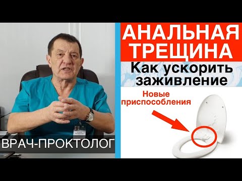 АНАЛЬНАЯ ТРЕЩИНА (ЧАСТЬ 7) — как ускорить заживление. Приспособления для снижения боли.