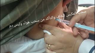 حقنة مسكن اولفين عضل 💉