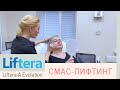 SMAS-лифтинг для лица с деформационным типом старения