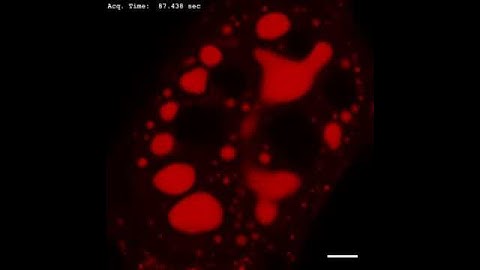 Spinodal decomposition of FUS Corelets in live cells