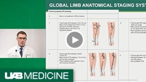 Chronic Limb-Threatening Ischemia