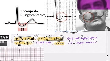A A 10 Class VI Digitalis    Toxicity Revisions