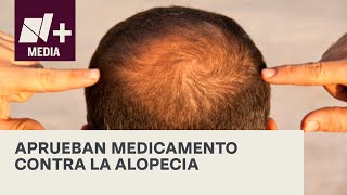 Aprueba FDA primer medicamento contra la alopecia - Bien y Buenas YouTube