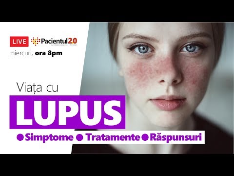 Lupus. Simptome, tratament, răspunsuri