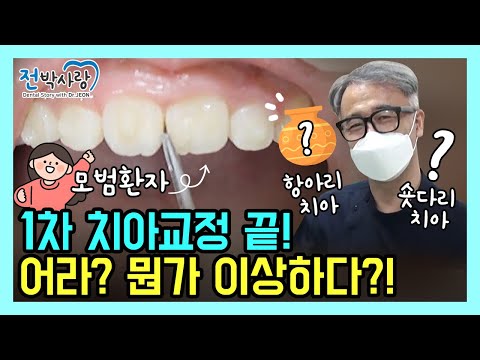 치아 모양이 다른데...? 교정 끝나도 안 이쁜 치아!?😲