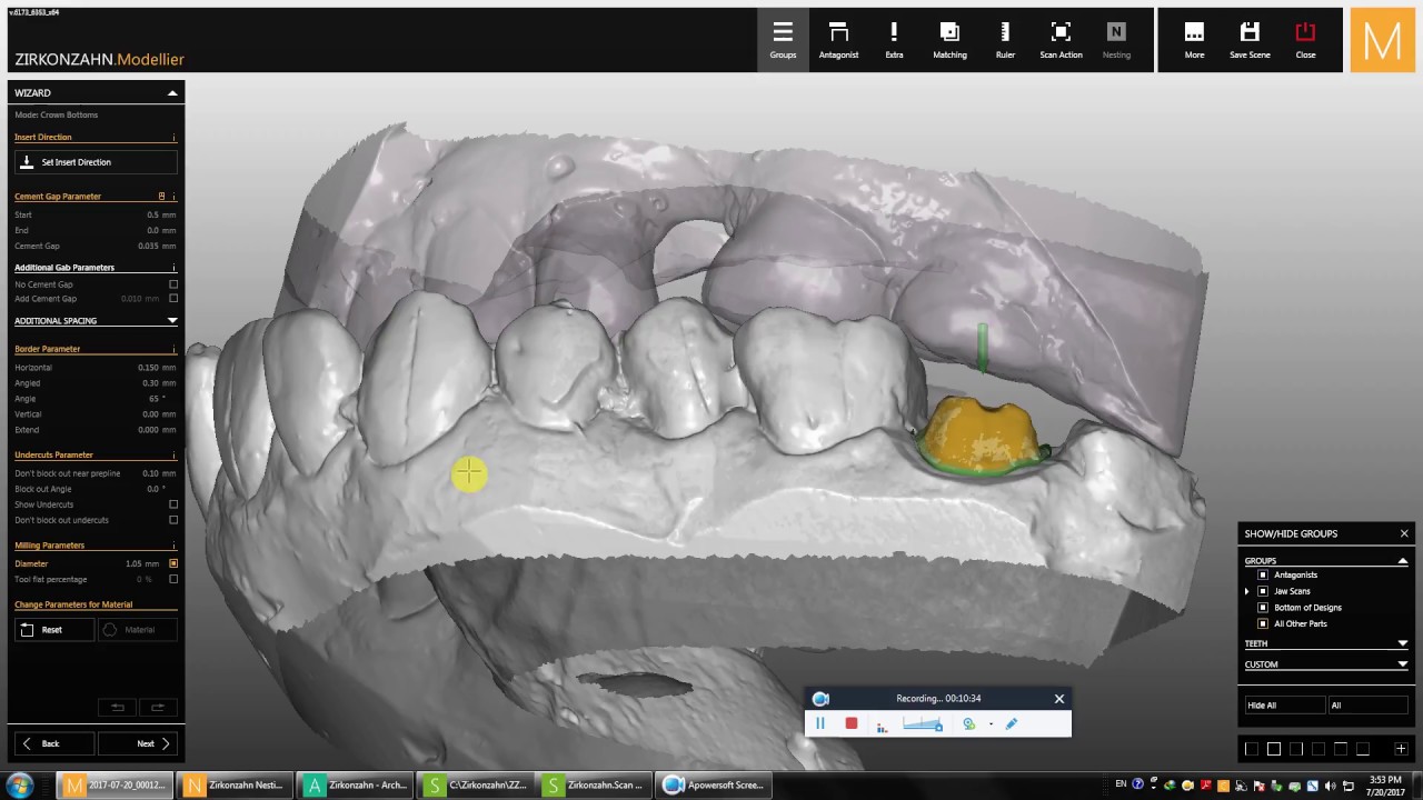 Zirkonzahn شرح مبسط للمبتدأين عن طريقه عمل 1 يونيت علي الكاد كام