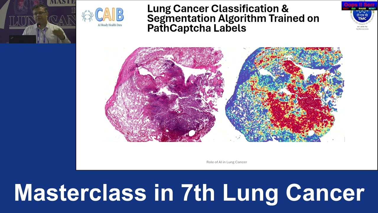 Dr  Swapnil Rane  AI in Lung Tumour Biology & Patient Care  CRSF 07th Lung Cancer Masterclass V