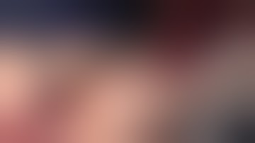 v3 Parallax visualization of frames extracted from a 2D surgical video