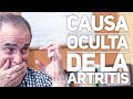 Episodio #1385 Causa oculta de la artritis