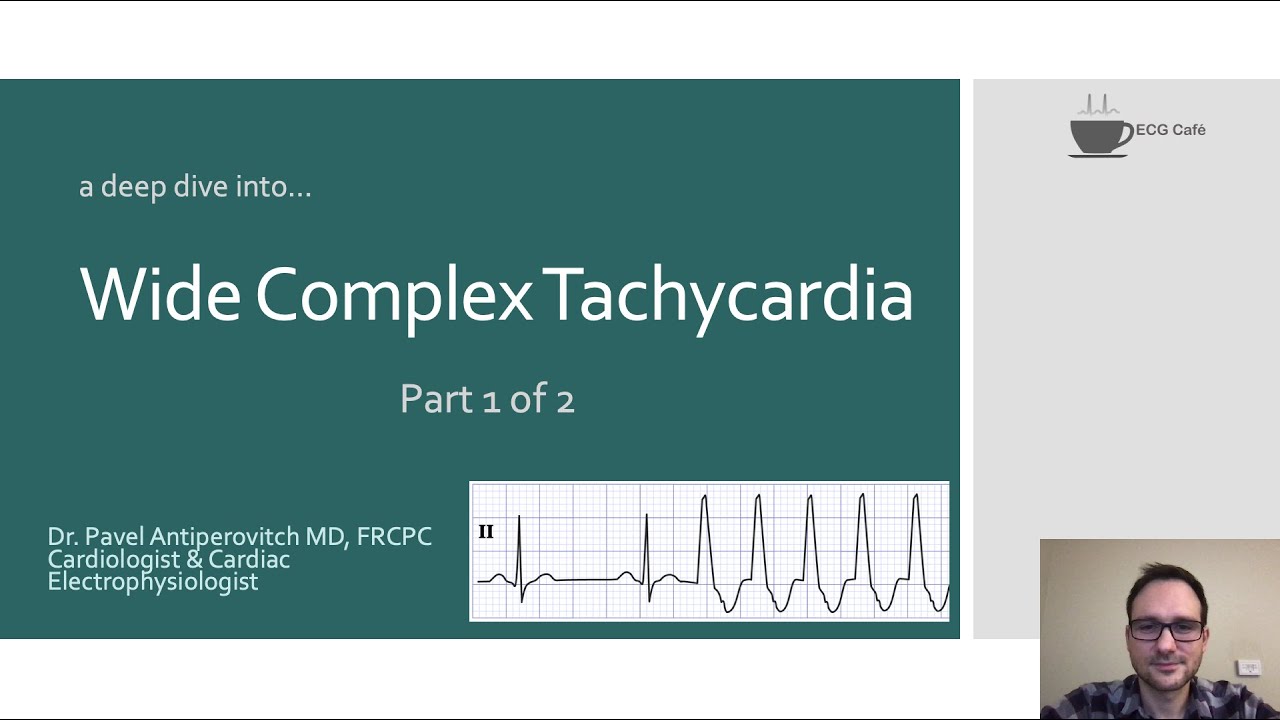Wide Complex Tachycardia (Part 1 of 2) INTERMEDIATE / ADVANCED - YouTube