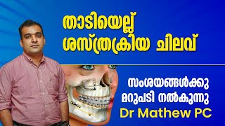 All You Need To Know About The Cost Of Jaw Surgery In India | Dr Mathew PC