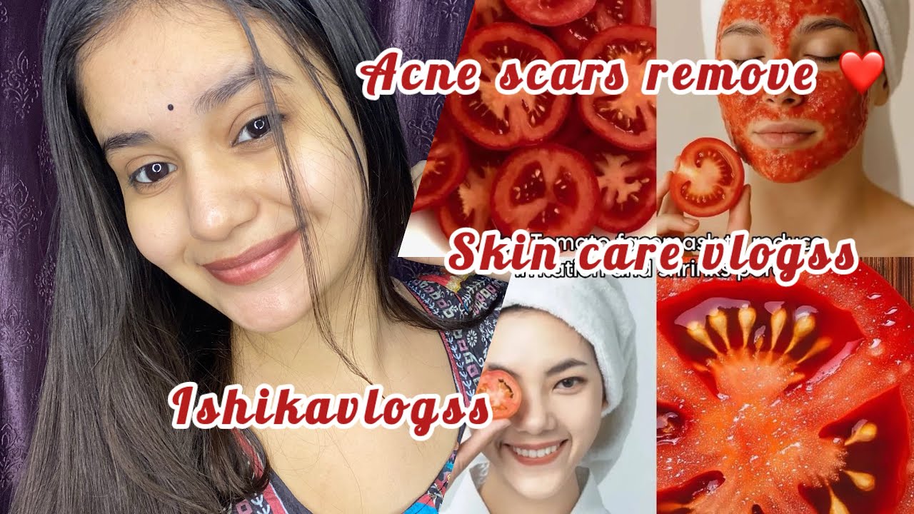 Daag dhabbe kaise gayab kare? Yeh try karo😱❤️