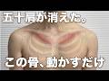 五十肩が消えます。第1肋骨のロックを外して動かしてください。