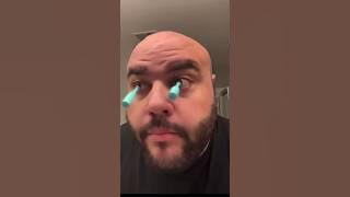 MY EYEBALL CAME OUT🙄