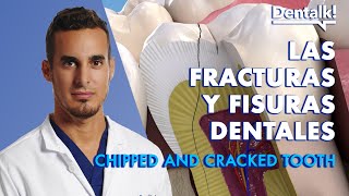 Have you BROKEN a TOOTH? Causes and how to REPAIR a dental FRACTURE or CRACK | Dentalk! © by Dentalk! 6,803 views 3 months ago 3 minutes, 59 seconds