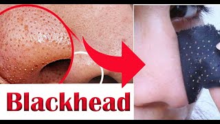 How to make blackhead nose strips at home