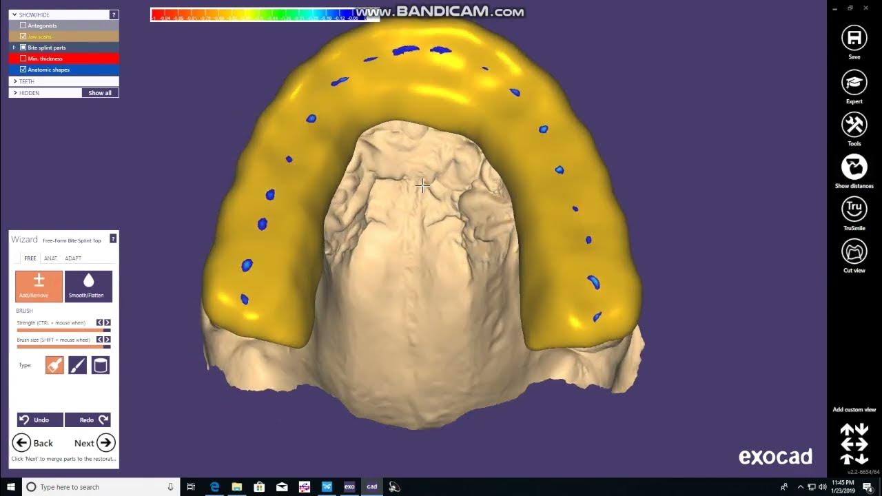 Occlusal Night Guard Design and Print Using Exocad and Formlabs 2 YouTube