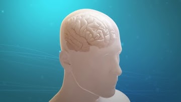 Deep Brain Stimulation (DBS) Explained | Advanced Treatment for Parkinson & Tremors at IBS Hospital