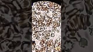 Get an Amazing Look at COVID-19 Under the Microscope!#microscope #viral #ytshorts #youtubeshorts