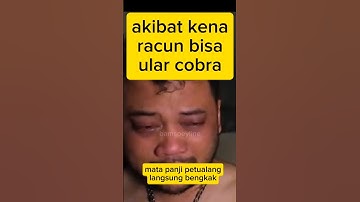 mata kena bisa ular cobra😨 #bamspeyline #videoviral #shortsvideo #fyp #foryou #panjipetualang #cobra