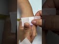 Injection Technique Made Simple | Types of Needle Injections You Need To Know 15