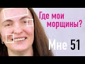 ДУМАЕШЬ, ЧТО ЗНАЕШЬ ВСЕ О МОРЩИНАХ? КАКИЕ ОНИ БЫВАЮТ И КАК ИХ УБРАТЬ? - ОТВЕТ ВРАЧА КОСМЕТОЛОГА