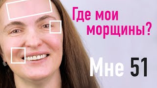 ДУМАЕШЬ, ЧТО ЗНАЕШЬ ВСЕ О МОРЩИНАХ? КАКИЕ ОНИ БЫВАЮТ И КАК ИХ УБРАТЬ? - ОТВЕТ ВРАЧА КОСМЕТОЛОГА