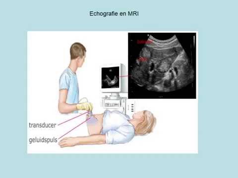 Echografie en MRI