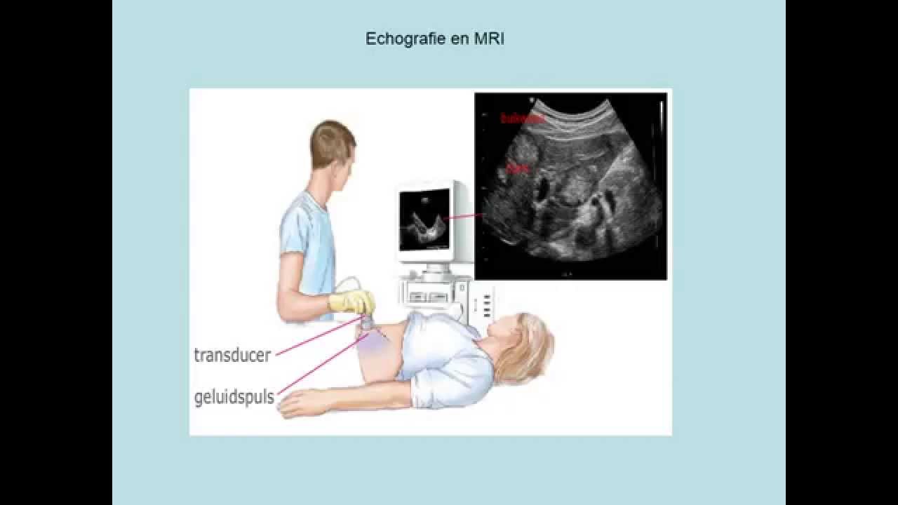 Echografie en MRI