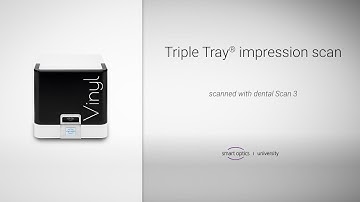 Vinyl - Real-time - Triple tray impression scan