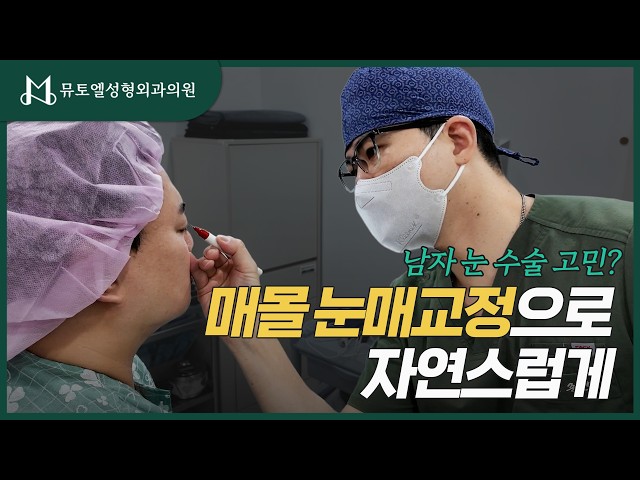 남자 눈 수술 고민? 매몰 눈매교정으로 자연스럽게! #남자눈매교정 #남자눈성형 #눈매교정 #매몰눈매교정 #남자쌍꺼풀 #남자쌍수 #남자눈수술 #눈성형 #쌍꺼풀수술 #매몰법