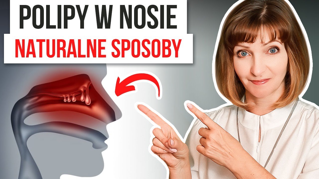 Co To Znaczy Mieć Muchy W Nosie 🍀 POLIPY w NOSIE. 🍀 Bez tego nie pozbędziesz się polipów na stałe