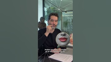 Needle or Cannula? | MD Codes Q&A Session