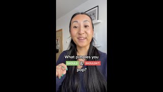 What pimples you SHOULD and SHOULDN’T pop? screenshot 2